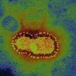 Coronavirus de Wuhan, descubierto en 2018, desastre en 2020